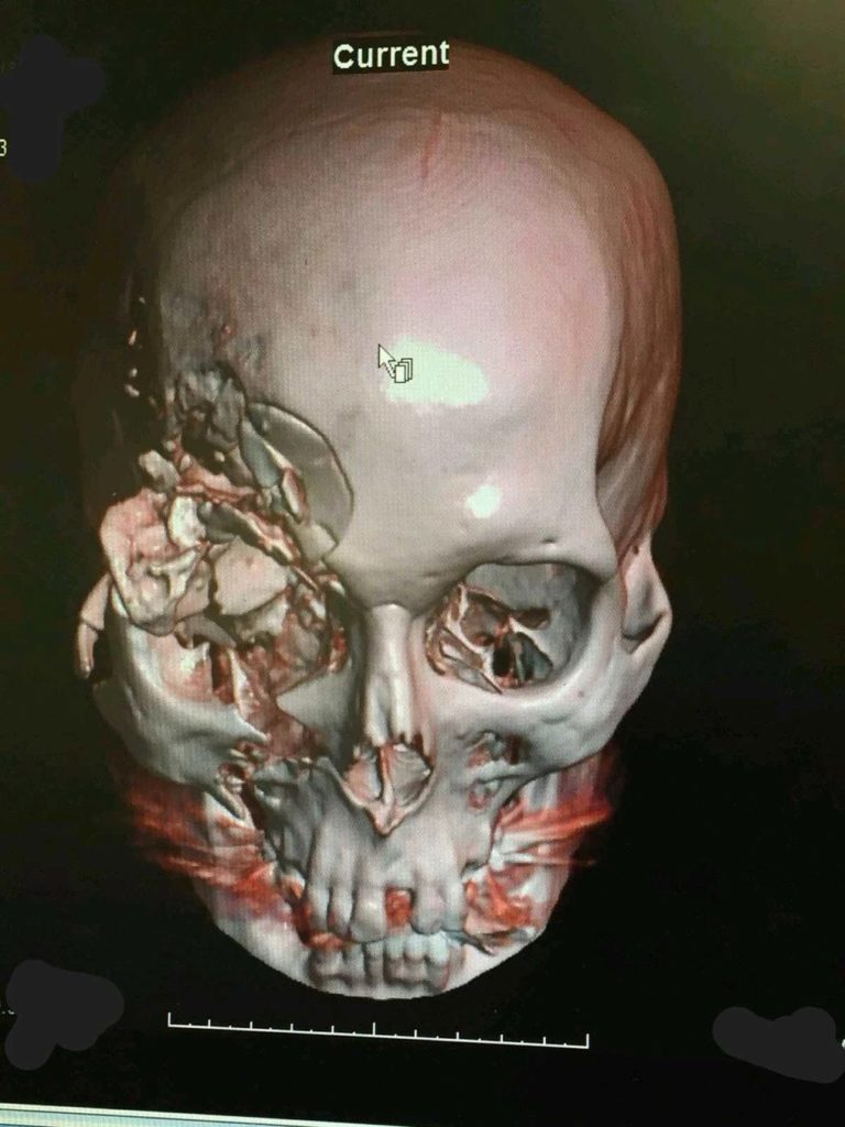 Medical imaging of a skull. 