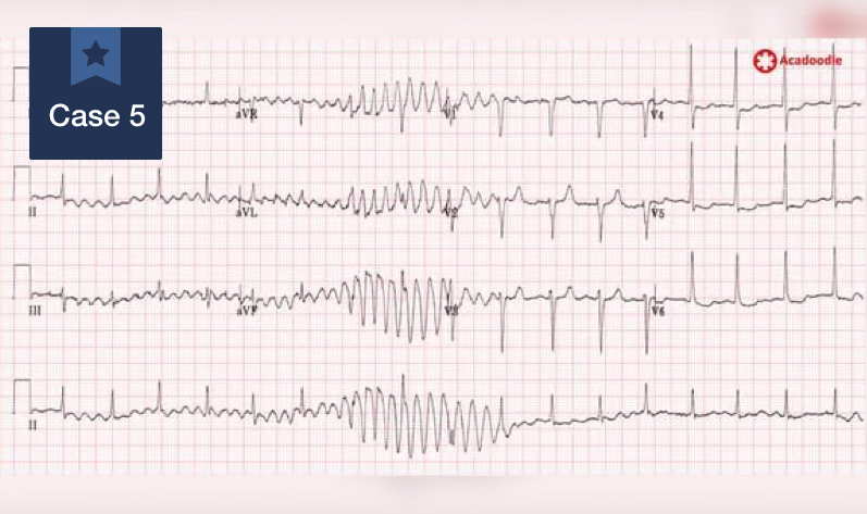 #5 medical case of 2021