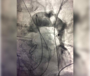 Most interesting medical cases in cardiology