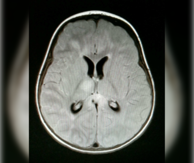 Most interesting medical cases in neurology