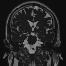 Neurology case