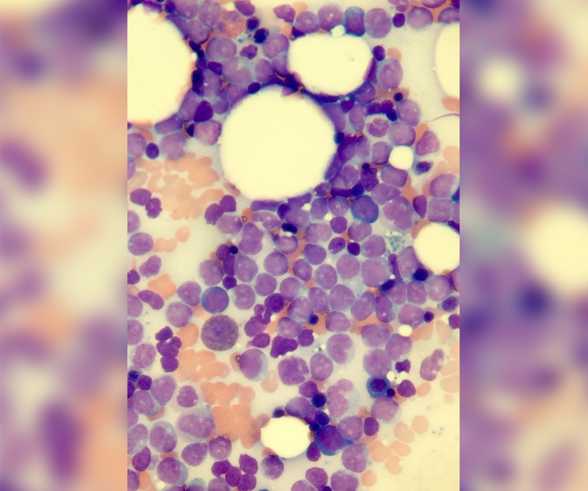 Advances and Trends in Hematology Figure 1