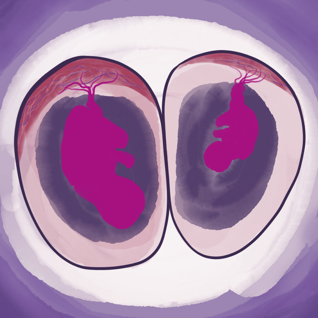 Season 7 Episode 2 - watercolor image of twins in utero. One smaller. 