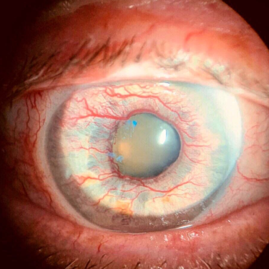 The Most Interesting Medical Cases in Ophthalmology