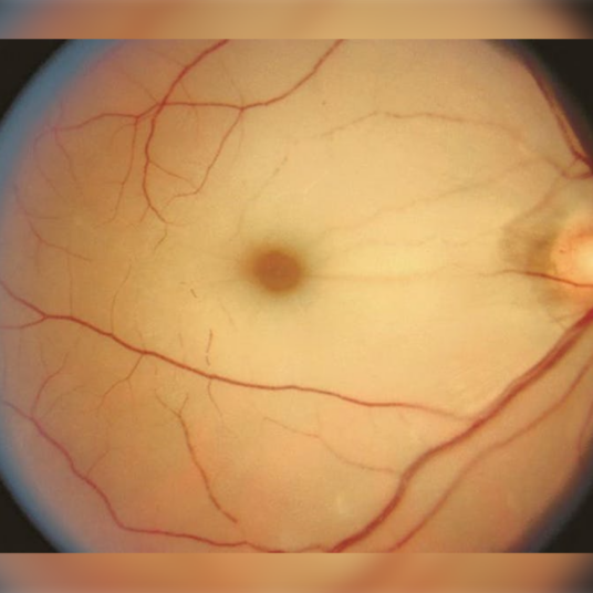American Academy of Ophthalmology Joins Figure 1