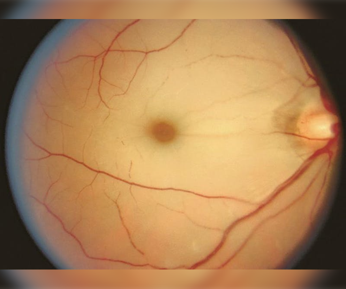 American Academy of Ophthalmology Joins Figure 1 Figure 1