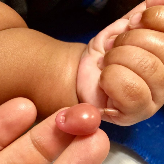 The Most Interesting Medical Cases in Pediatrics